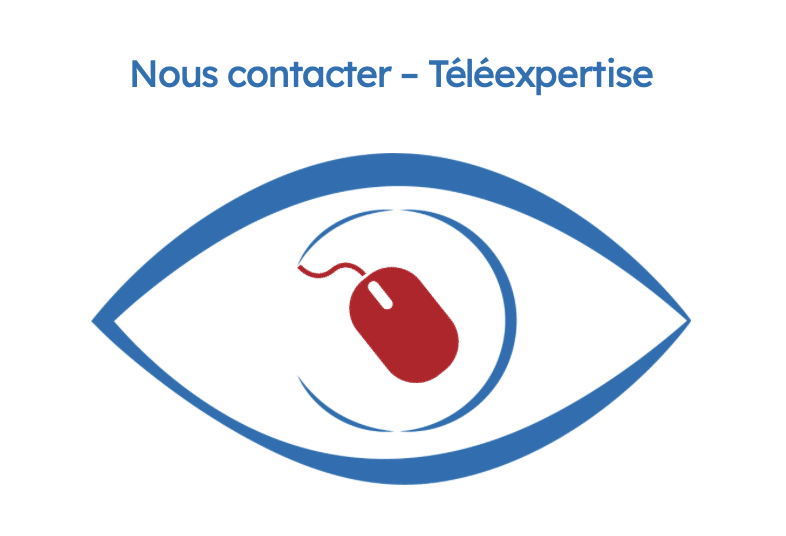 teleexp ess opthalmo