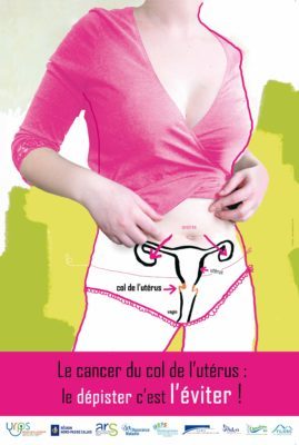 cancer col uterus 269x400